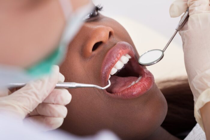 treating damaged teeth in Baltimore County