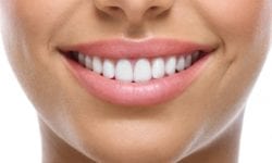 Why You Shouldn't Stop Ignoring Your Crooked Teeth