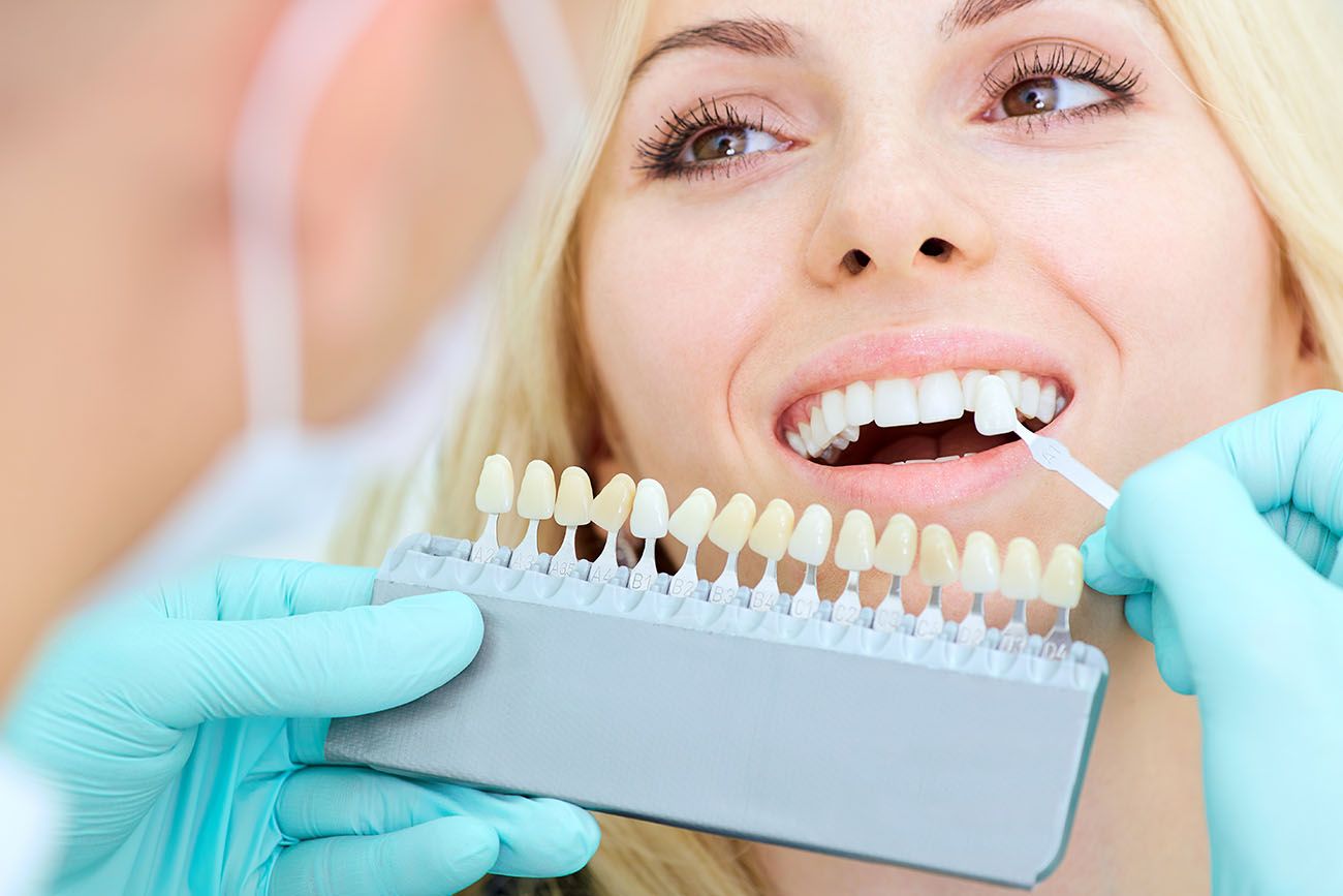 porcelain veneers dentist owings mills md